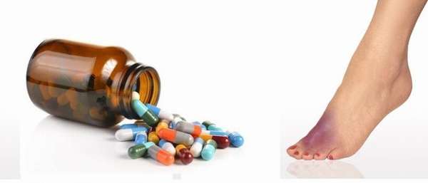 Таблетки от подагры на ногах: эффективные и недорогие лекарства, какие лучше принимать
